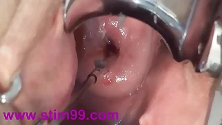 Cervix Fucking Play Yawning chasm Japanese Asian - å­å®®é ¸éƒ¨ã‚¯ã‚½